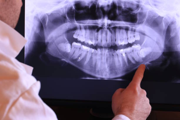 Best Emergency Orthodontic Repairs in Mclendon Chisholm, TX