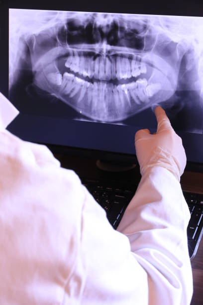 Best Emergency Root Canal Treatment in Mclendon Chisholm, TX