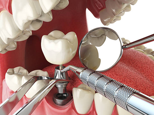 Best 24-Hour Emergency Dentist in Mclendon Chisholm, TX